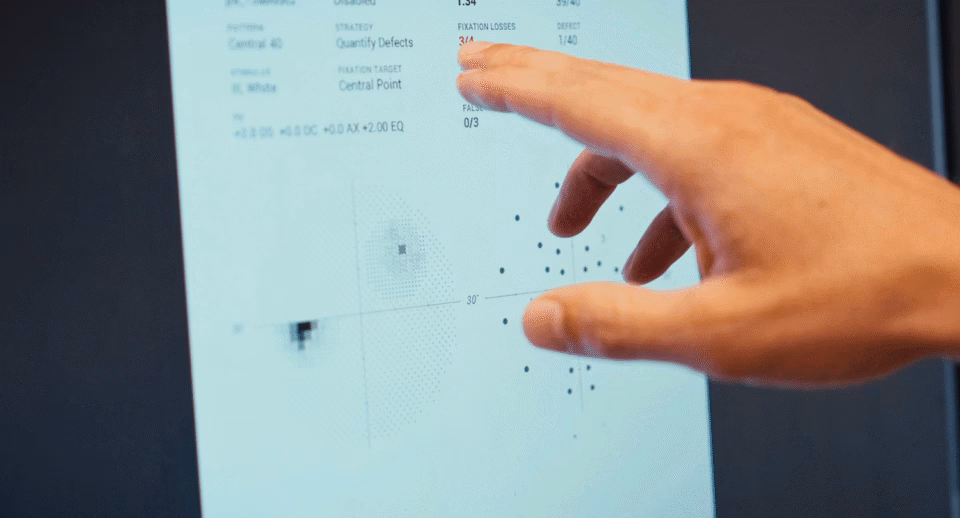 A hand pointing to a screen displaying a Carrot Visual Field test report.