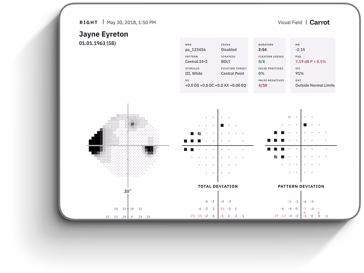 A screen displaying a Carrot visual field test report.