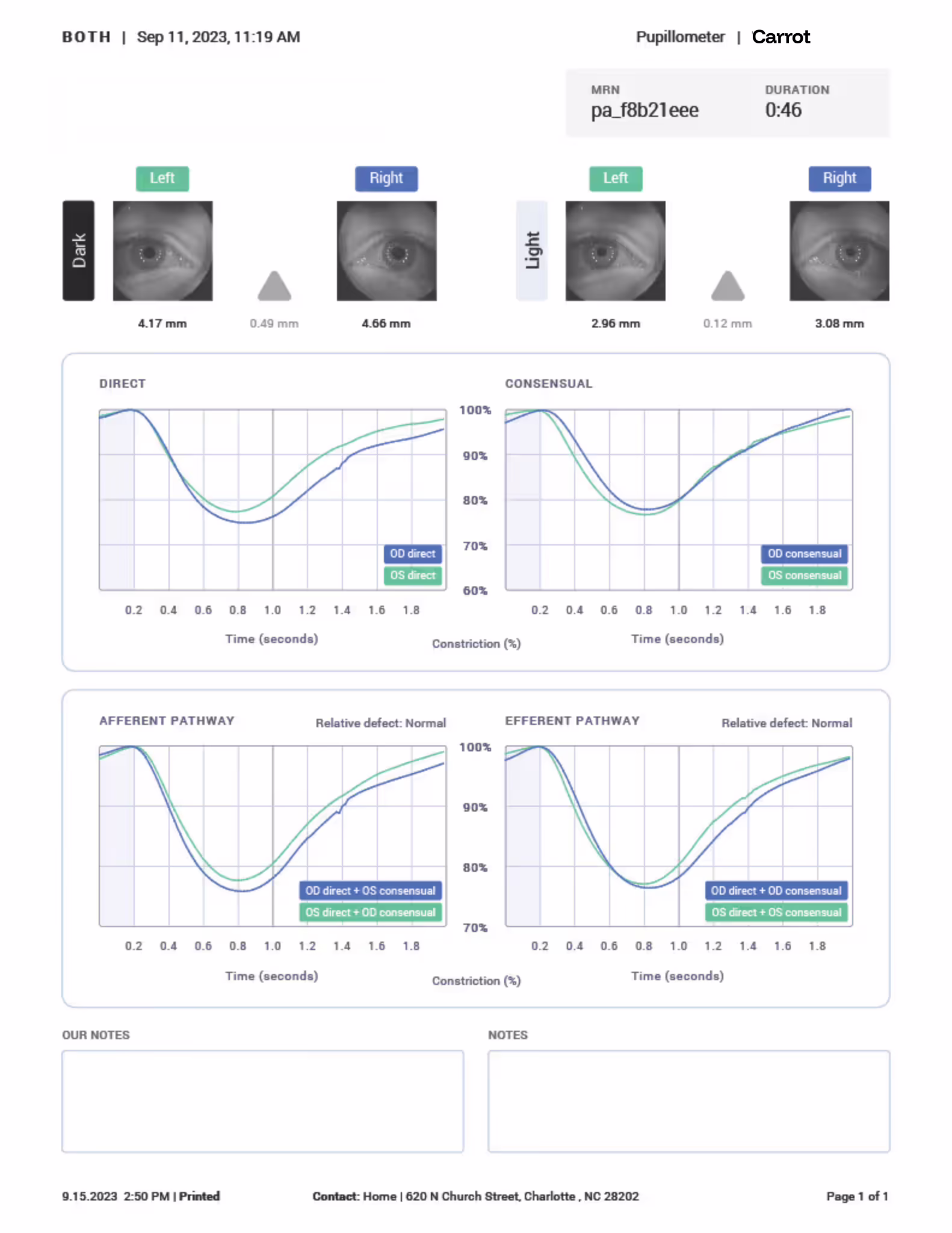An image of a sample pupillometer report from Carrot
