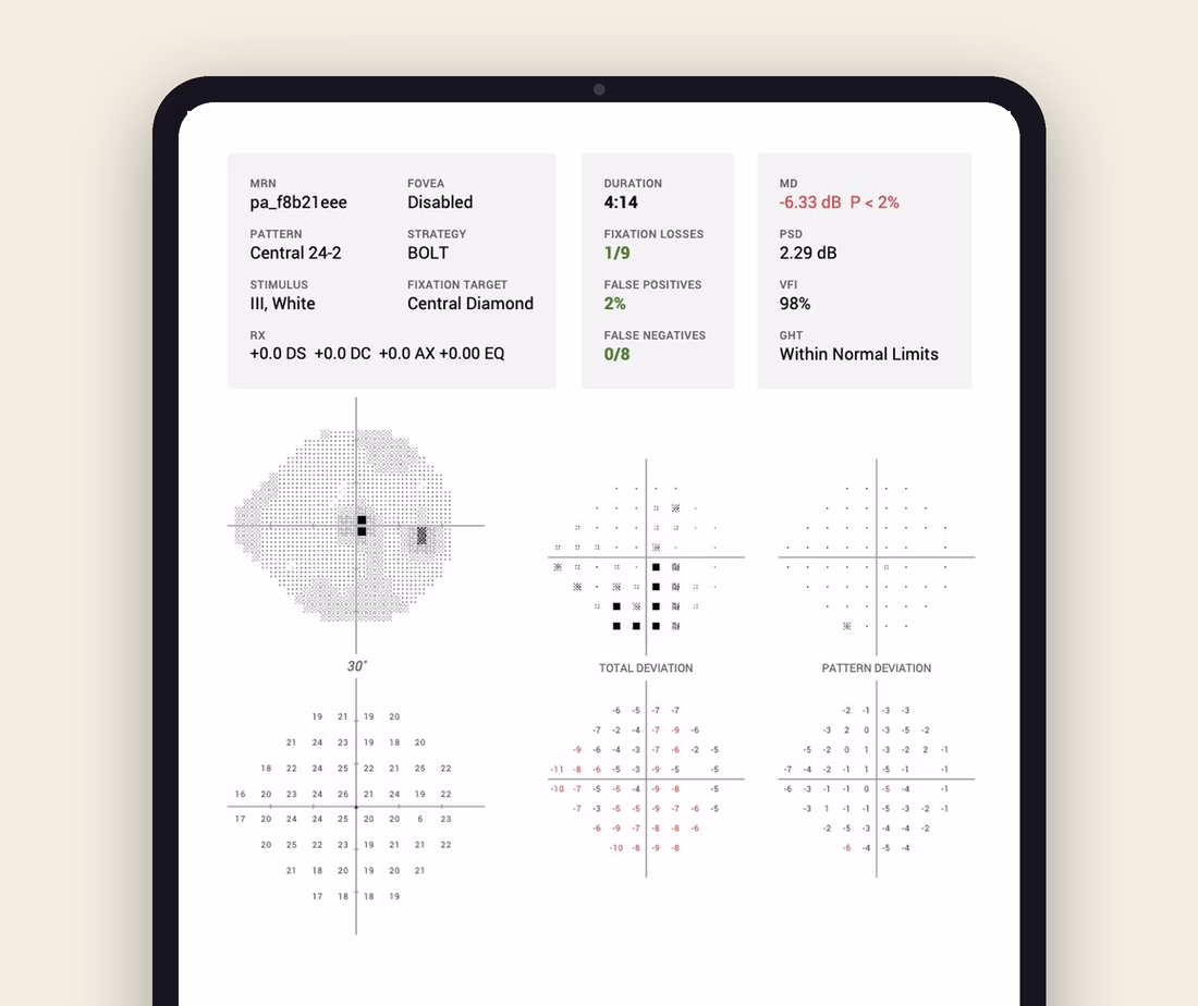 visual field threshold report