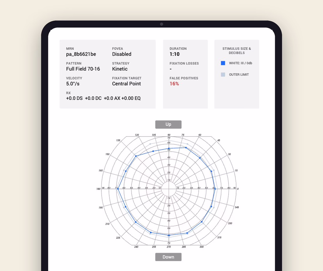 kinetic testing