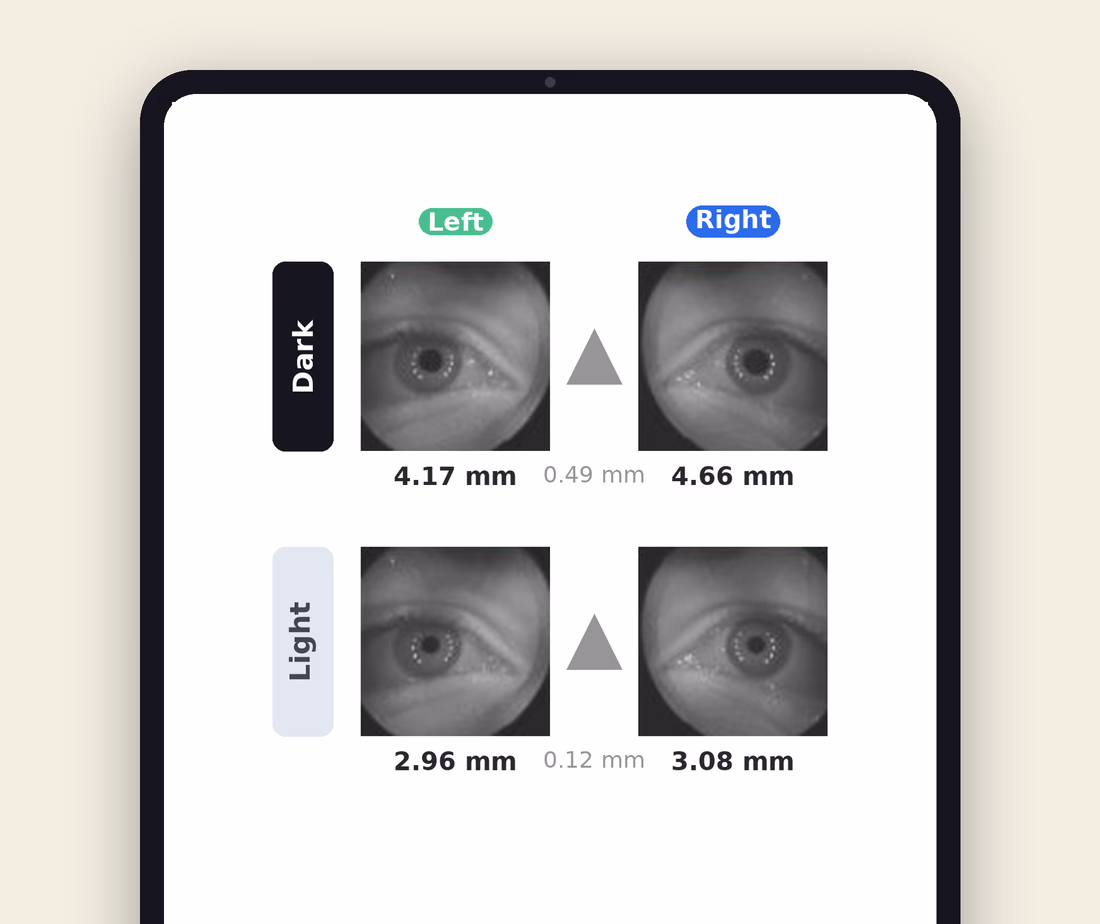 Pupil Diameter Measurements